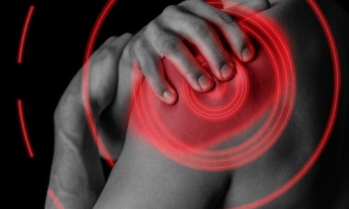 Common Symptoms You May Not Realize Are Caused By a Rotator Cuff Tear