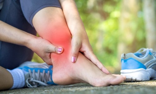 Simple ankle sprain: Don't ignore it!